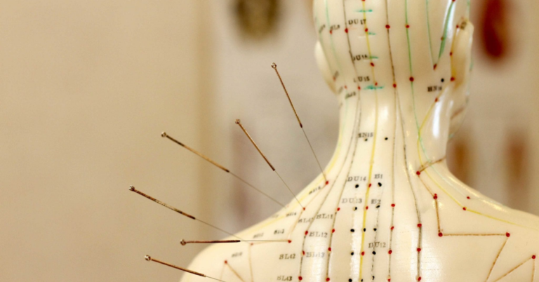 The Comprehensive Guide to Understanding and Experiencing the Best TCM Acupuncture for Holistic Healing